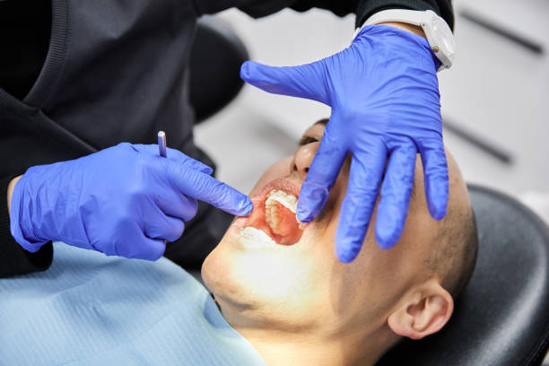 Best Emergency Root Canal Treatment in Fair Oaks, CA
