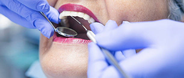 Best Emergency Treatment for Toothache in Fair Oaks, CA